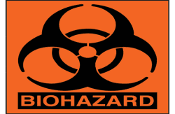 Questions to Ask Your Commercial Biohazard & Crime Scene Cleanup